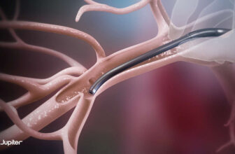 Neptune Medical Raises $97M, Launches Jupiter Endovascular